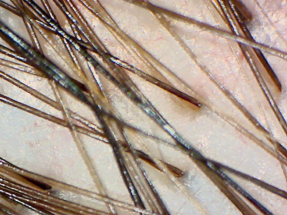 50x magnified image of individual hair shafts of different thicknesses.