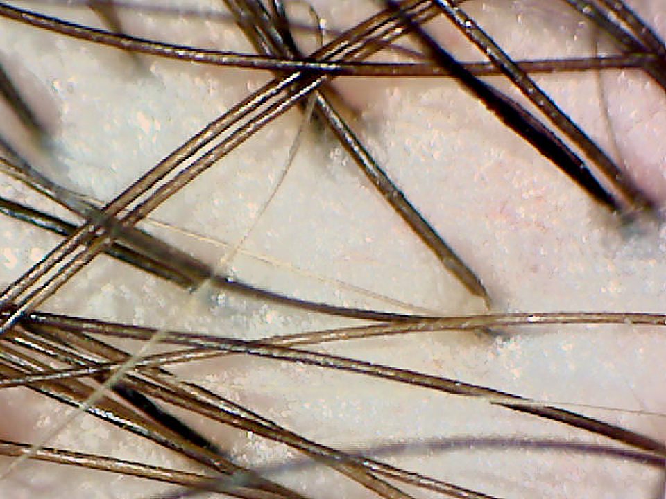 50x magnified image of hair from the side of the head.