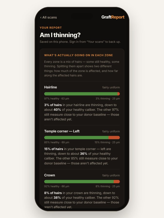 Report screen: what is going on in each zone, showing the share of hairs thinning and how far.